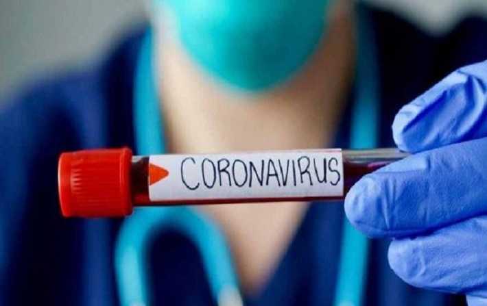 540 حالة إصابة جديدة بفيروس كورونا
