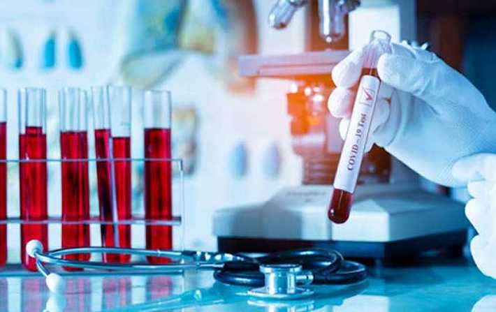 وزارة الصحة:
80 اصابة جديدة بفيروس كورونا منها 71 محلية