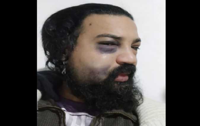 الصحفي سيف الوسلاتي يتعرض لاعتداء بالة حادة أثناء عمله!
