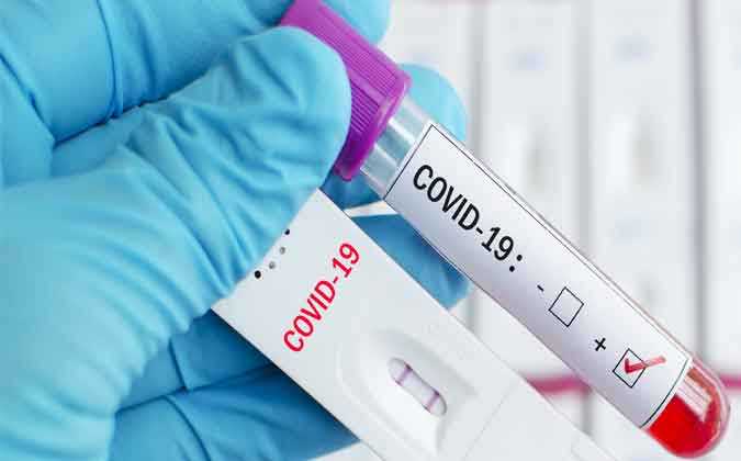 الى حدود يوم امس الاثنين : تسجيل 1598 حالة إصابة جديدة بفيروس كورونا 