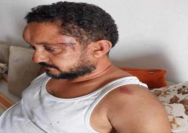 الاعتداء على الصحفي سفيان بن نجيمة : ايقاف الامنيين عن العمل 